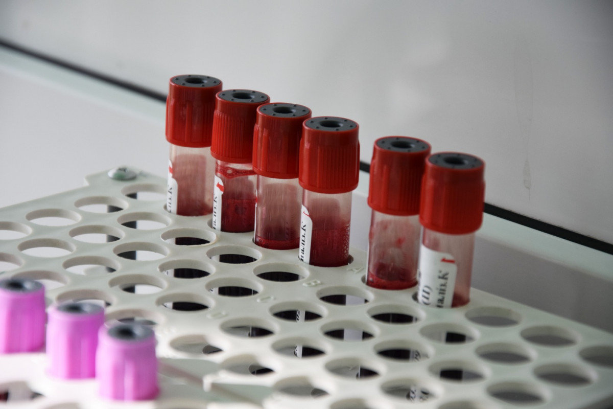 Кров для фронту і тилу: волинські прикордонники поповнили банк крові