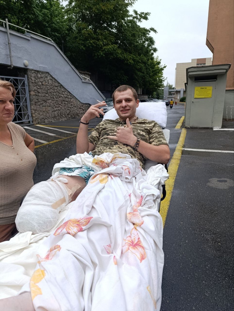 Втратив ногу на війні, але не жагу до життя: історія ветерана з Волині, який відкрив власну справу