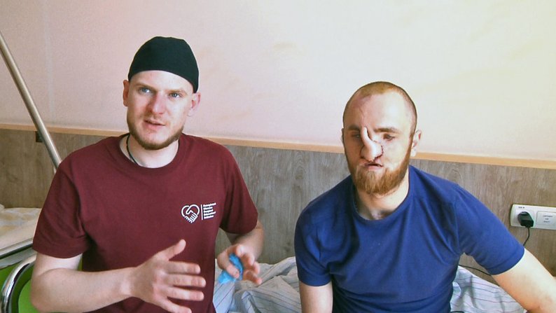 «Взагалі не було носа»: команда хірургів відновлюють обличчя 28-річному військовому з Волині