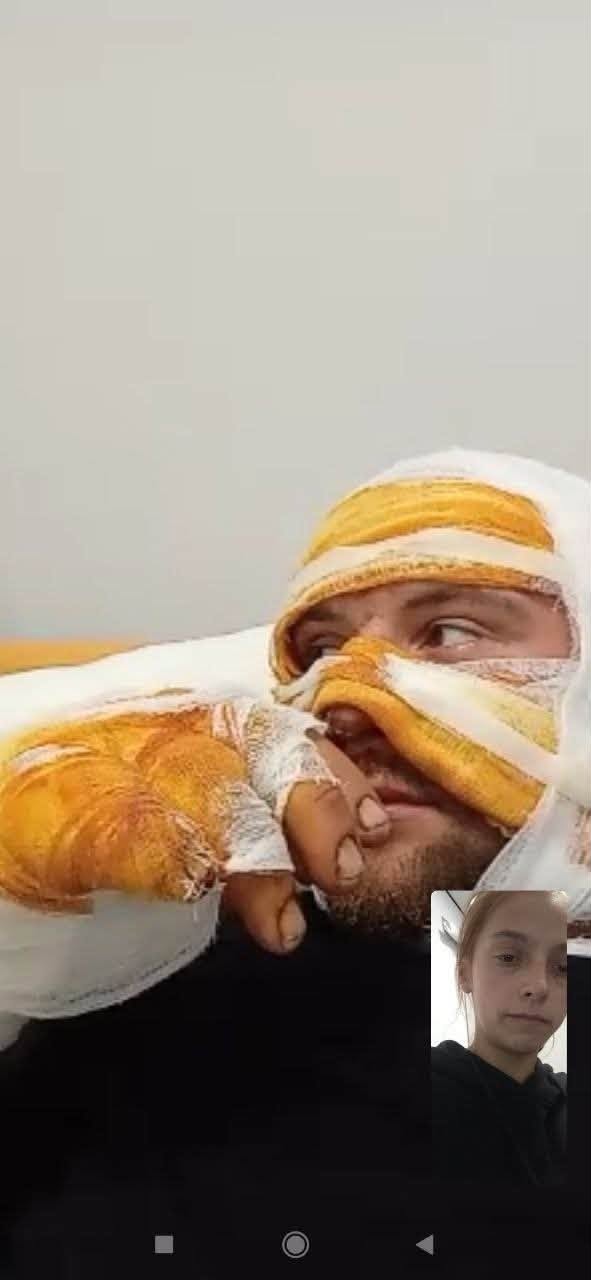 На Волині пожежа знищила частину будинку батька-одинака з трьома дітьми: родині потрібна допомога