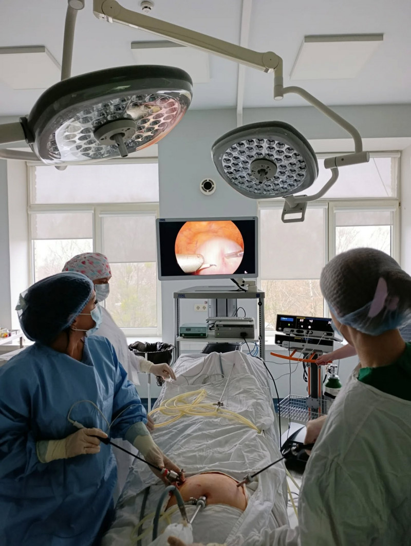 На Волині лікарі без великих розрізів видалили велику кісту яєчника