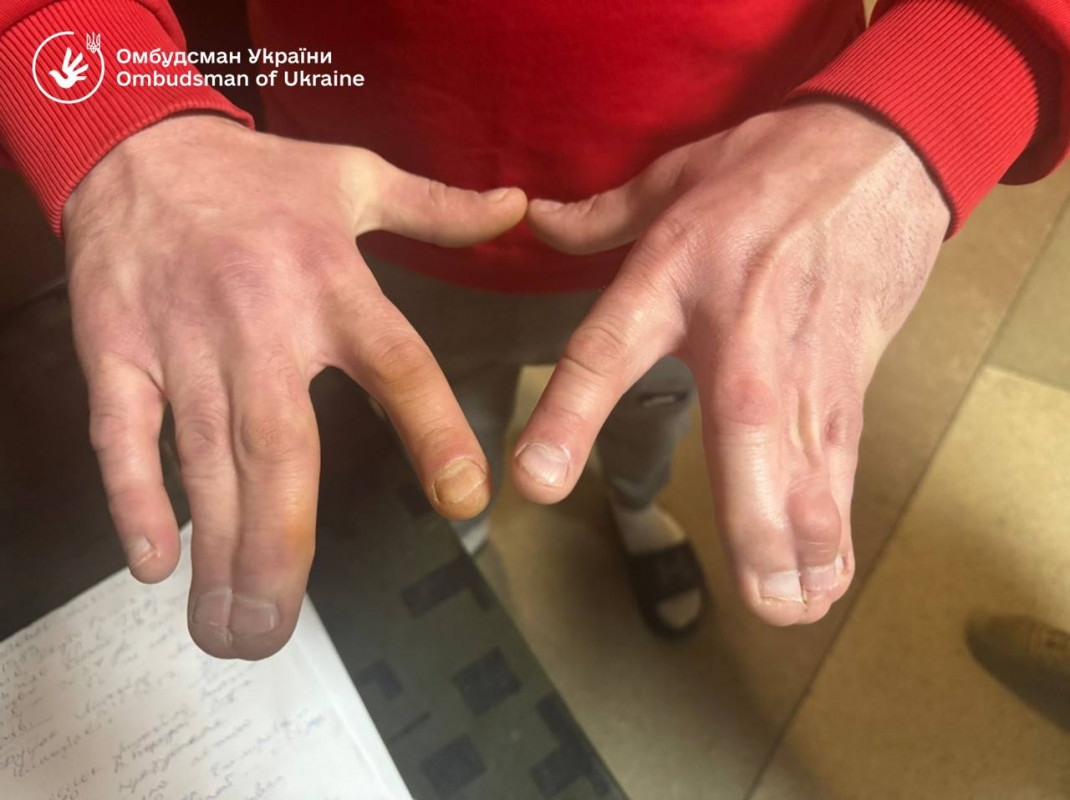 В Ужгородському ТЦК виявили серйозні порушення прав людини — омбудсман. Відео