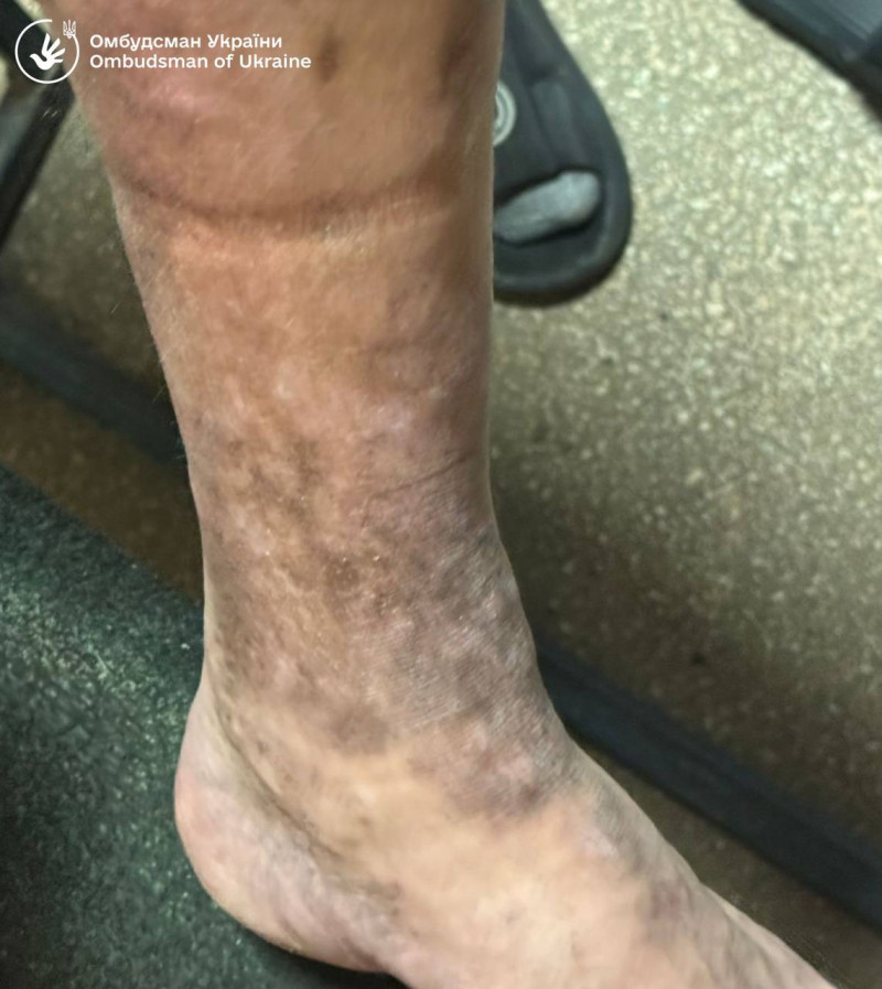 В Ужгородському ТЦК виявили серйозні порушення прав людини — омбудсман. Відео