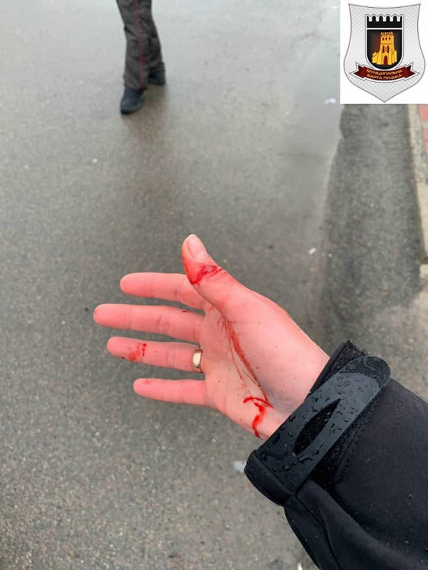 У Луцьку через автохама напали на муніципалку та вкрали її телефон. Відео 18+