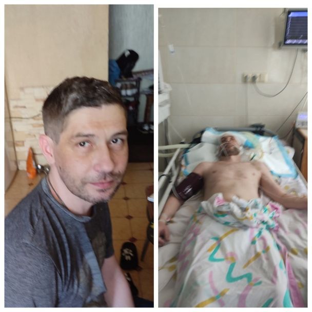 Скандал під час мобілізації: чоловік впав у кому після відвідин ТЦК