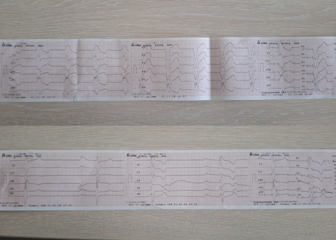 Життя на лінії «103»: історії порятунку трьох волинян із серцевими кризами