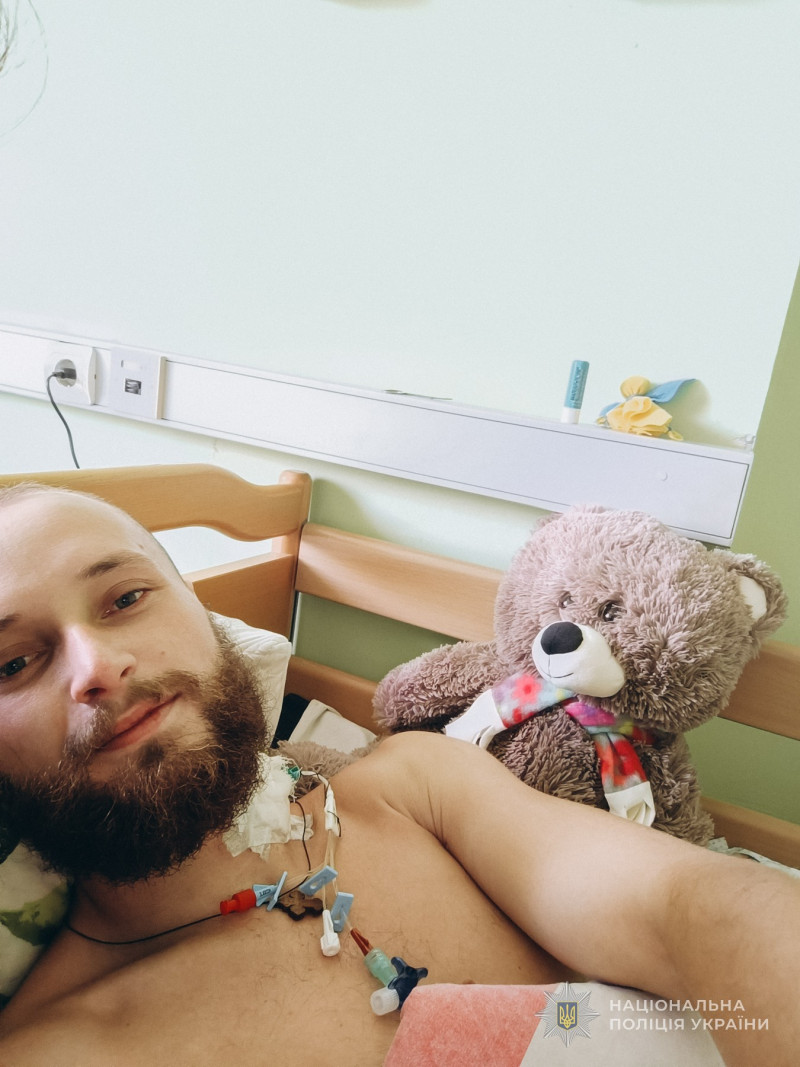 Лікарі не вірили, що ходитиме: історія ветерана з Волині, який після важкого поранення працює в поліції