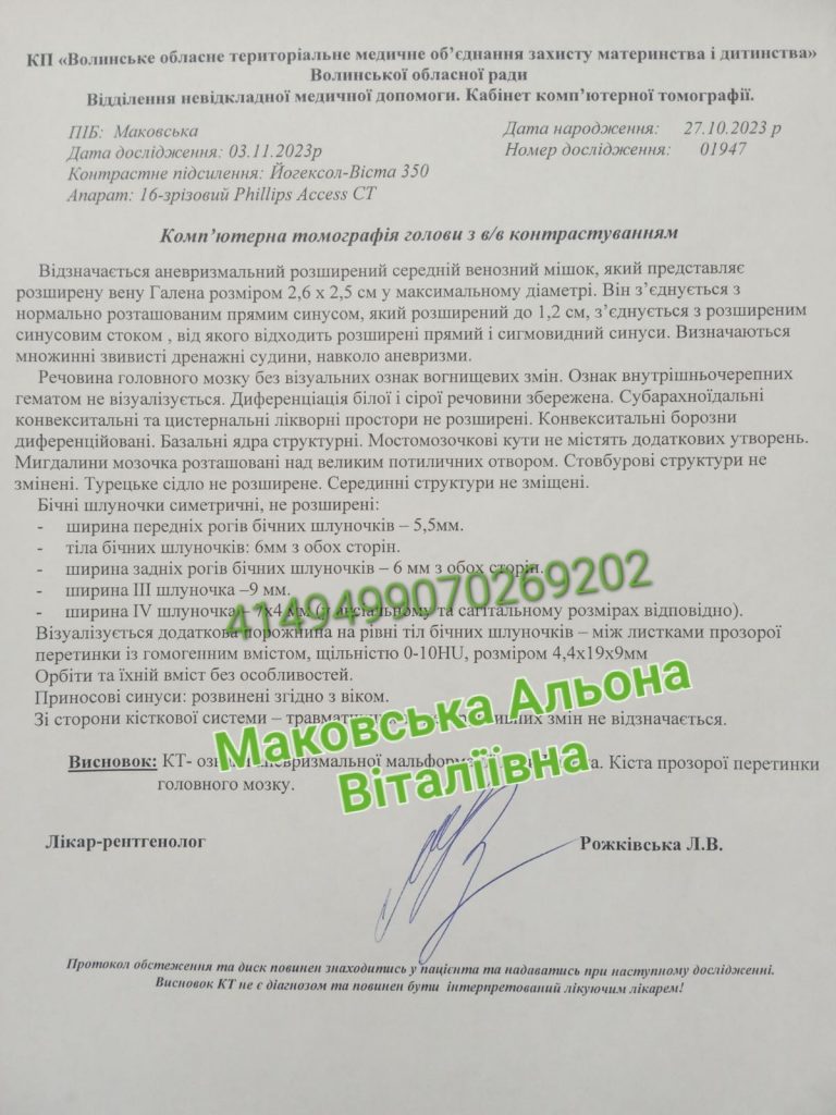 Народилася з вродженою вадою в голові: маленька волинянка з перших днів бореться за своє життя