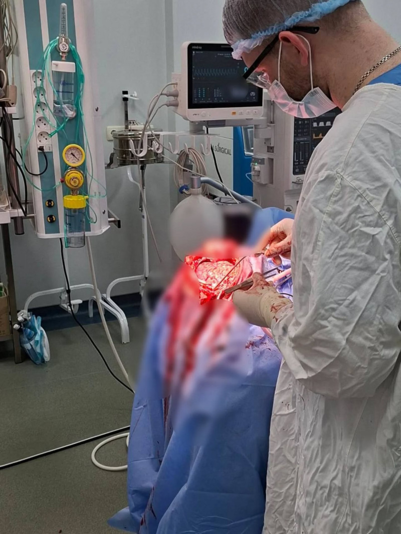 Триває боротьба за життя: волинянину провели надскладну операцію на головному мозку