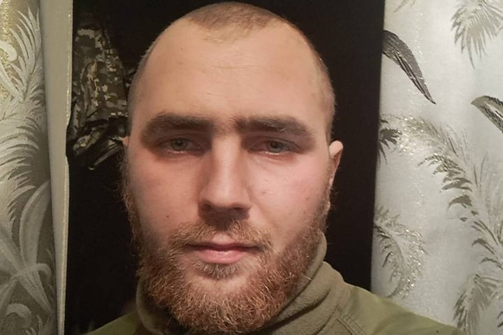 29-річному ветерану з Волині відновлюють обличчя після тяжкого поранення
