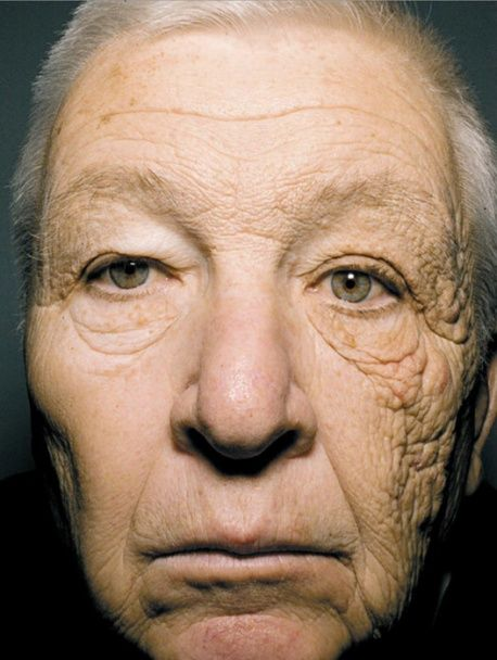 Як захистити шкіру в літній період: поради луцької дерматологині
