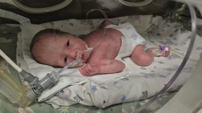 У Луцьку медики виходили дівчинку-«поспішайку», яка народилася з вагою лише 1240 грамів