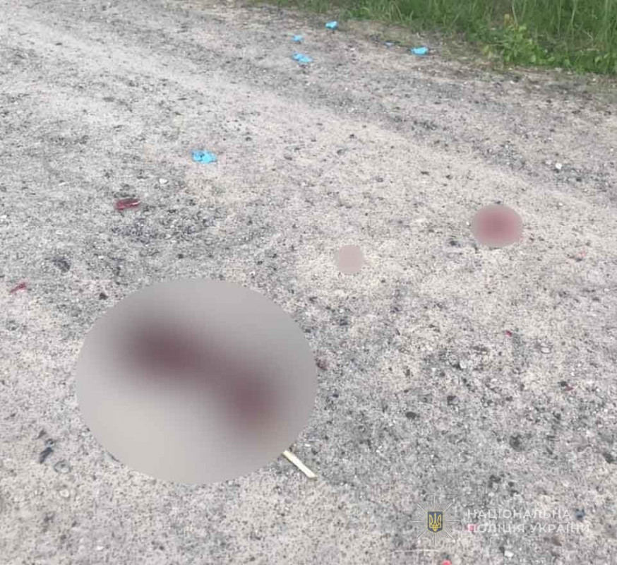 На Волині мотоцикліст впав на дорогу, він отримав політравму та численні переломи
