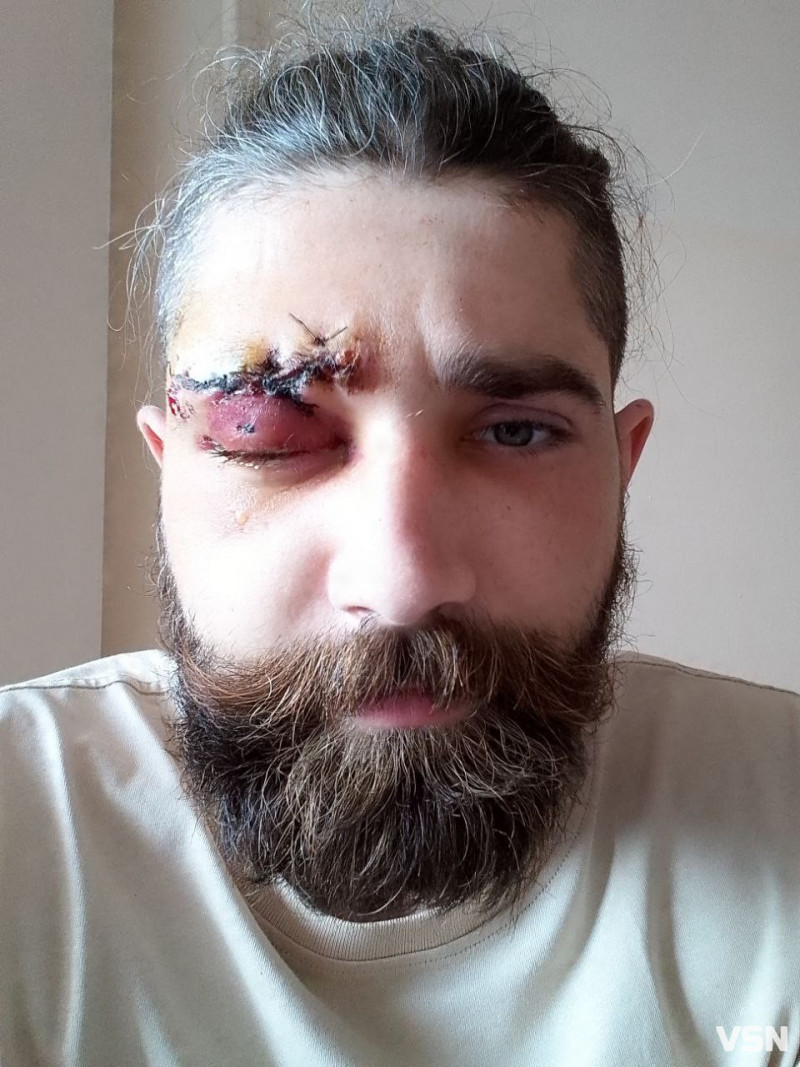 Колишніх азовців не буває, бо навіть у тилу можна залишитися у строю: спогади про бойові будні від військового медика Леоніда Бахіна з Волині
