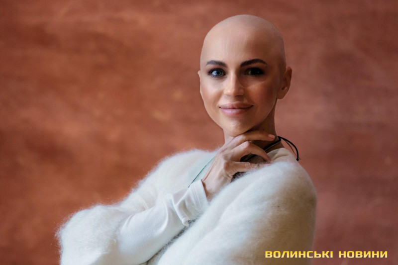 Незламна на сцені та в житті: як заслужена артистка Софія Матюшенко з Луцька бореться з онкологією і продовжує грати головні ролі