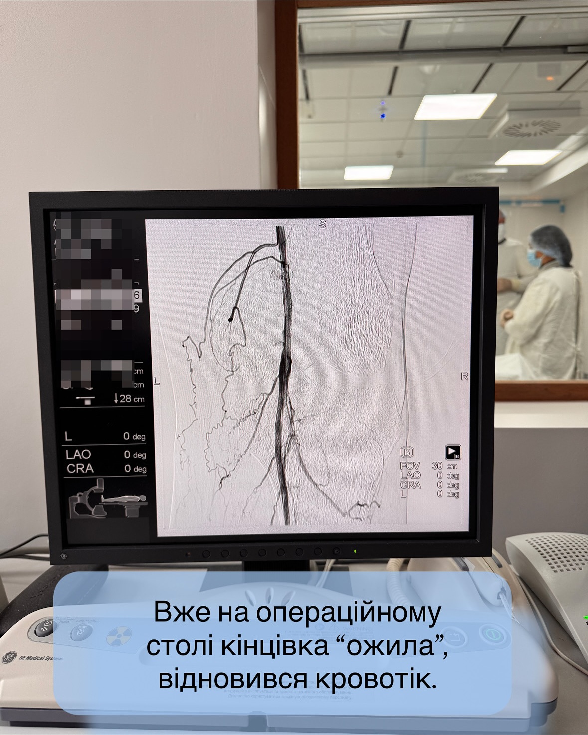 Кінцівка «ожила» на операційному столі: волинські медики врятували ногу пацієнта від ампутації