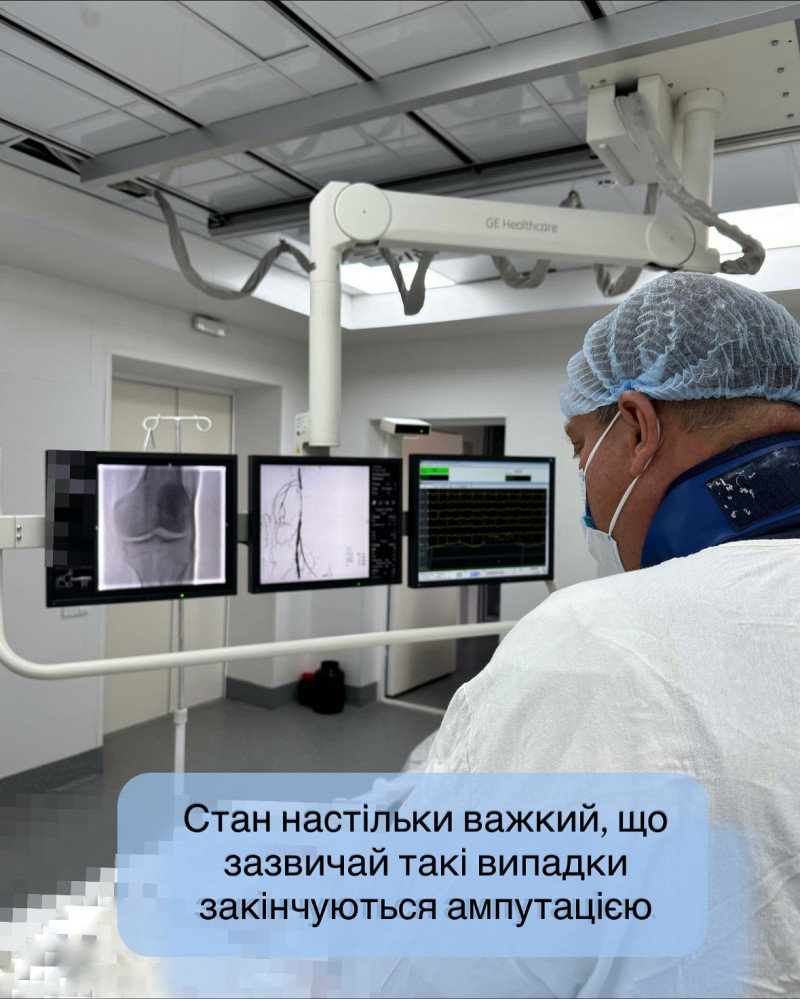 Кінцівка «ожила» на операційному столі: волинські медики врятували ногу пацієнта від ампутації