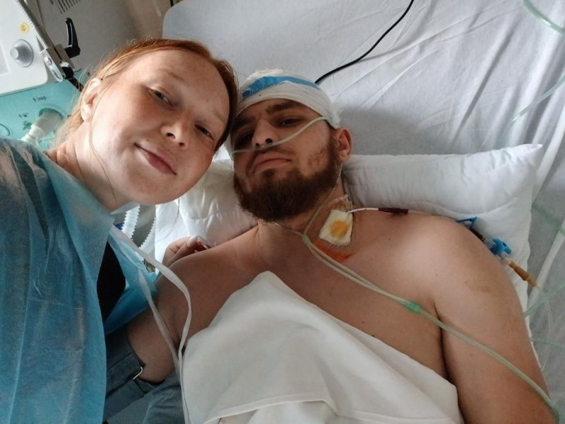 Втратив ногу на війні, але не жагу до життя: історія ветерана з Волині, який відкрив власну справу