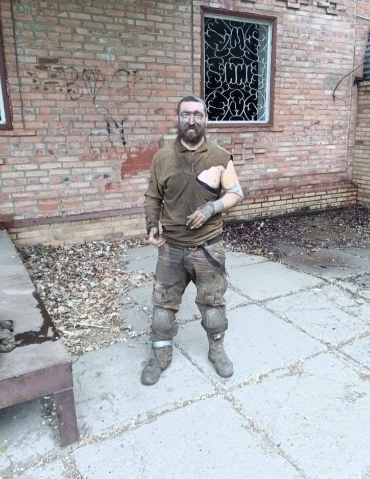 «Мене витягнули з пекла»: поліцейський-доброволець з Волині розповів про бойовий шлях, поранення і реабілітацію
