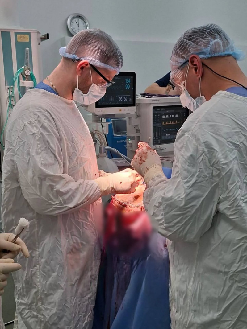 Триває боротьба за життя: волинянину провели надскладну операцію на головному мозку