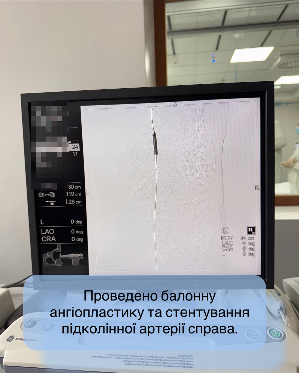Кінцівка «ожила» на операційному столі: волинські медики врятували ногу пацієнта від ампутації