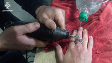 Волинські рятувальники допомогли підлітку зняти каблучку, яка застрягла на пальці