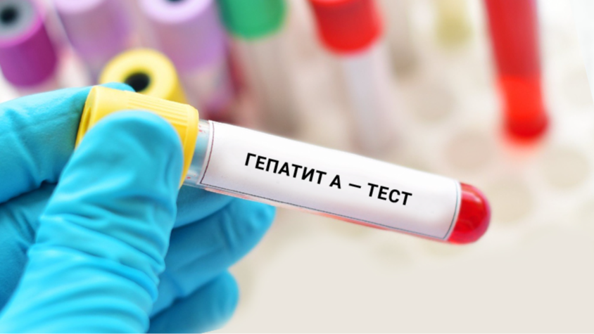 Медики розповіли, скільки людей на Волині захворіли на гепатит А у 2025 році
