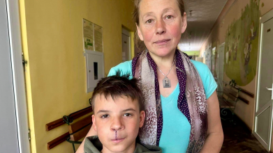 «Ображали через вроджену ваду обличчя»: у Львові хлопчику-сироті з Волині зробили операцію, яку він чекав 13 років