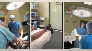 На Волині чоловіку ампутували кінцівку після обмороження, бо запізно звернувся