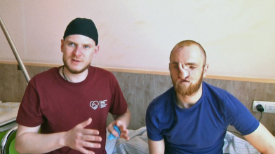 «Взагалі не було носа»: команда хірургів відновлюють обличчя 28-річному військовому з Волині