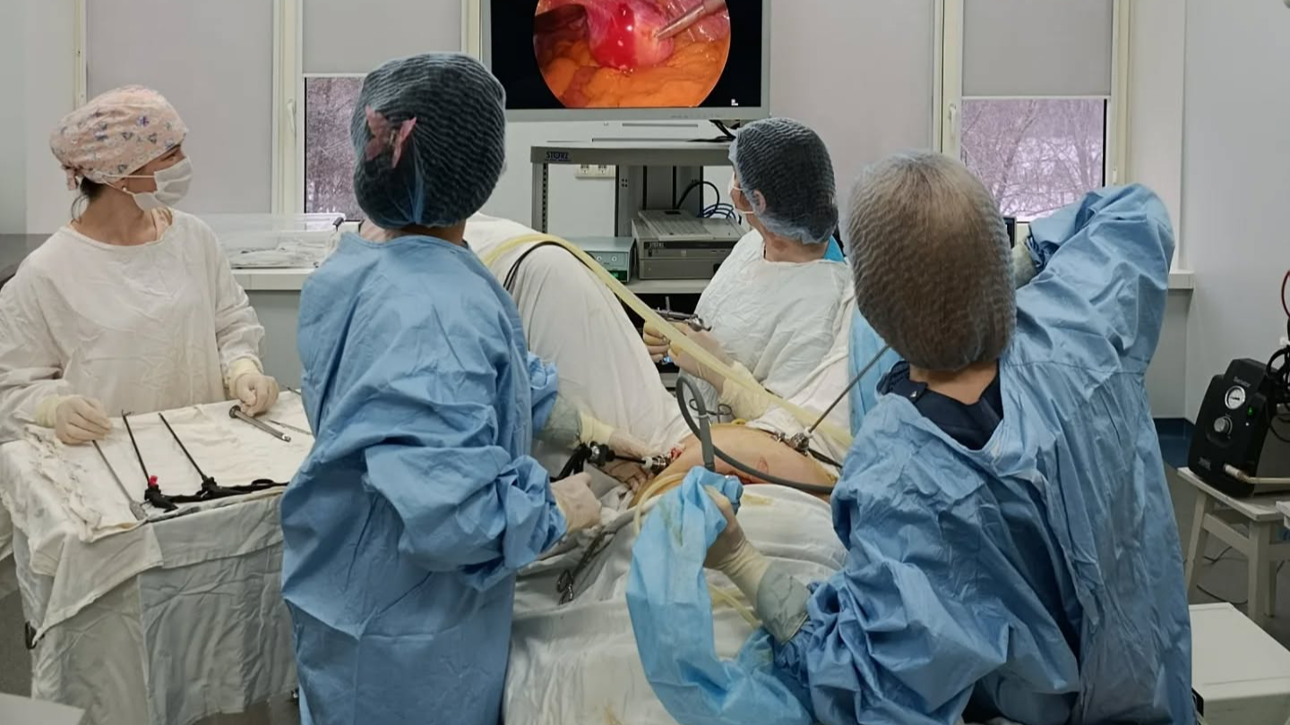 Волинянці видалили велику пухлину матки через невеликі проколи