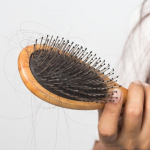 Чому взимку волосся ламається й випадає: як правильно за ним доглядати