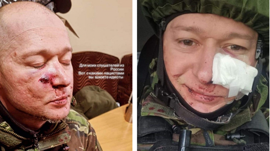 Андрій Хливнюк з "Бумбоксу" потрапив під мінометний обстріл окупантів й отримав поранення обличчя