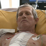 Їсть та п'є, хоче вже сідати та ходити: як почувається 65-річний волинянин, якому пересадили донорське серце