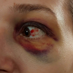 Вікторію Воловенко побили підлітки у трамваї № 8