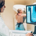 У центрі Луцька жінкам безоплатно робитимуть мамографію