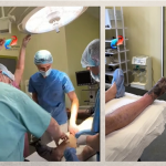 На Волині чоловіку ампутували кінцівку після обмороження, бо запізно звернувся