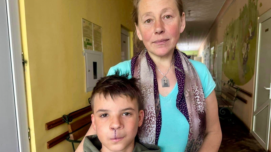 «Ображали через вроджену ваду обличчя»: у Львові хлопчику-сироті з Волині зробили операцію, яку він чекав 13 років
