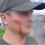 Побили лопатою обличчя та руки: на Волині чоловік напав на працівника ТЦК