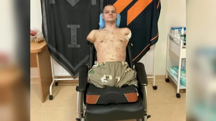 Без рук і ніг, але з незламною волею: як живе 20-річний ветеран Руслан Книш після фронту