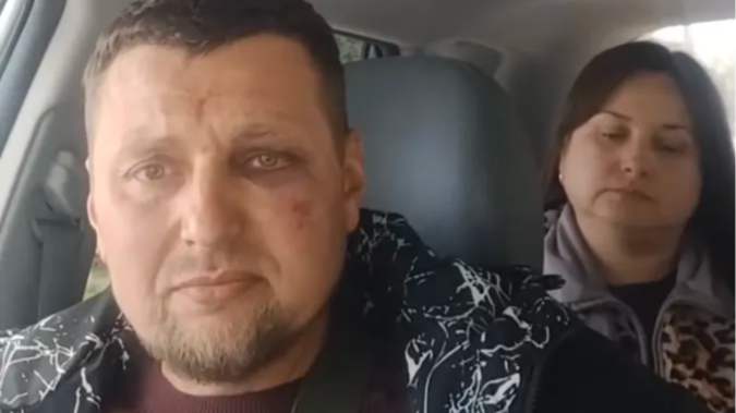 У Луцьку ветеран звернувся до поліції через побиття працівниками ТЦК: що відомо