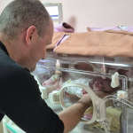 У Луцьку медики виходили дівчинку-«поспішайку», яка народилася з вагою лише 1240 грамів