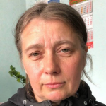 «Це мій хрест»: лучанка з вірою долає рак і потребує допомоги