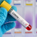 На Волині у новонародженої дитини виявили небезпечну інфекцію