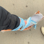 На Волині голова громади переїхав ногу тероборонівцю і втік, - ЗМІ