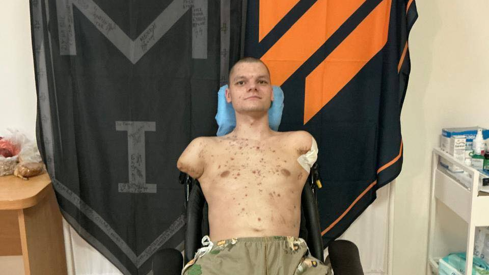 Військовому з ампутацією відмовили у ПриватБанку