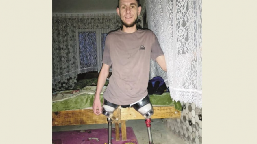 Втратив обидві ноги, пережив клінічну смерть і вижив: історія 29-річного захисника з Волині