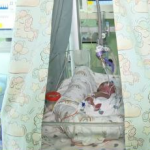 Волинські лікарі зробили диво: дві операції врятували немовля вагою всього 840 грамів