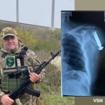 Військовий з Волині Тарас Ліпейко потребує коштів на протезування