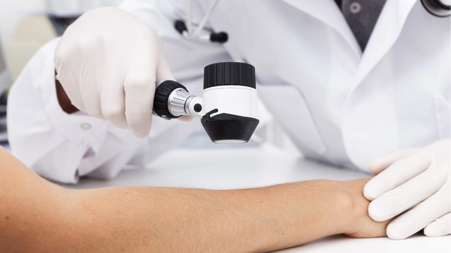 Чому консультація дерматолога важлива для шкіри